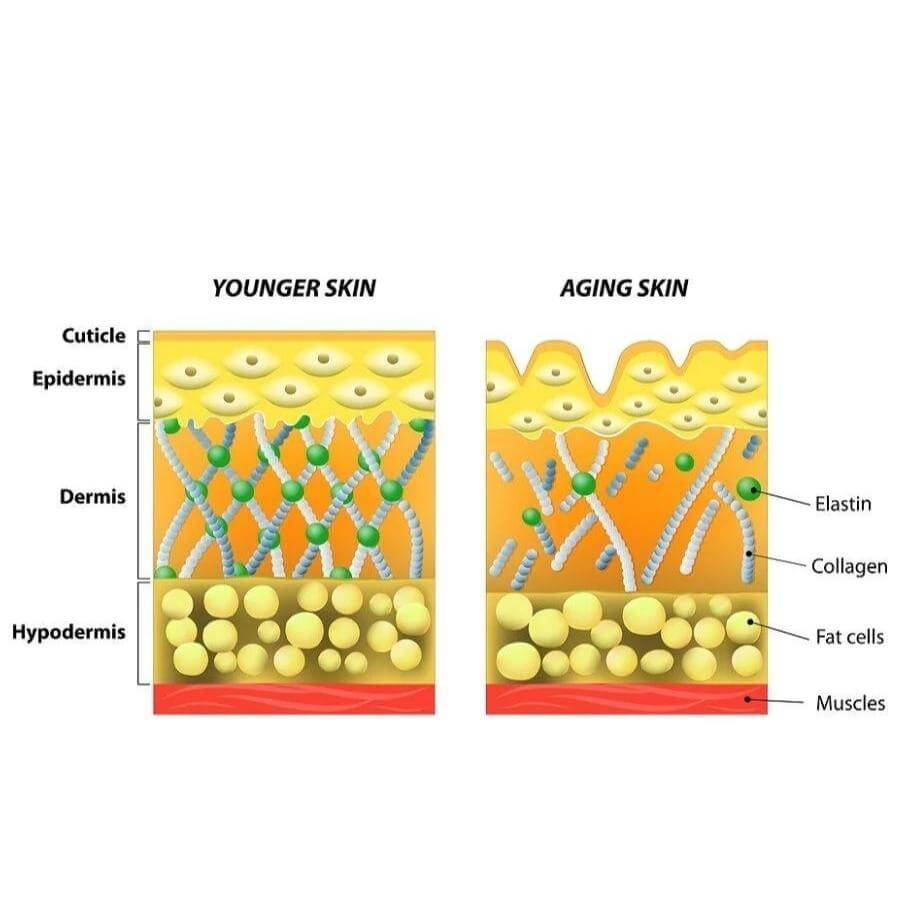 Matrixyl vs Hyaluronic Acid