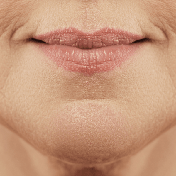 Cheapest peptide boosters for wrinkles?