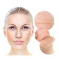Skin Perfection best sellers collection showcasing peptide-infused skincare products targeting large pores on cheeks