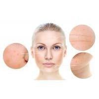 Skin Perfection best sellers banner highlighting top glycolic acid skincare products for smoother, glowing skin